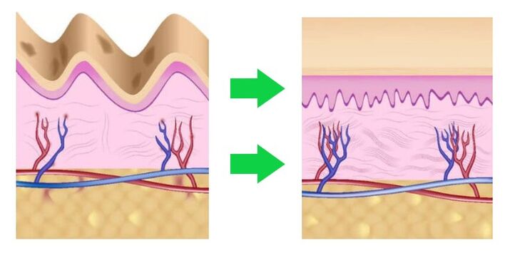 Intenskin equalizes the skin