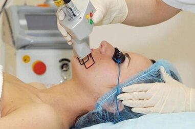 Types of laser skin rejuvenation