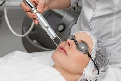 the benefits of laser rejuvenation